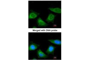 ICC/IF Image Immunofluorescence analysis of paraformaldehyde-fixed HeLa, using TBG, antibody at 1:200 dilution.