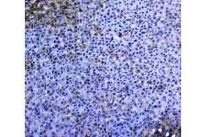 IHC analysis of TRAIL using anti-TRAIL antibody (ABIN5519065).