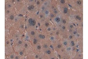 Detection of GSTm4 in Human Liver Tissue using Polyclonal Antibody to Glutathione S Transferase Mu 4 (GSTm4)