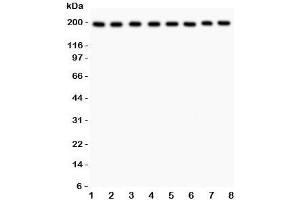 Western blot testing of ZO-1 antibody and Lane 1:  rat liver;  2: mouse liver;  3: (r) NRK;  4: (r) PC12;  5: human HeLa;  6: (h) SMMC-7721;  7: (m) HEPA;  8: (h) COLO320 lysate. (TJP1 anticorps  (AA 1178-1527))