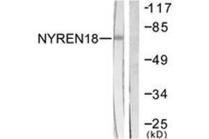 Western blot analysis of extracts from COS7 cells, using NYREN18 Antibody. (NUB1 anticorps  (AA 566-615))