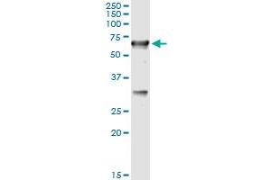 anti-Cystathionine-beta-Synthase (CBS) (AA 1-100) antibody