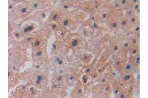 Detection of LOXL2 in Human Liver Tissue using Polyclonal Antibody to Lysyl Oxidase Like Protein 2 (LOXL2)