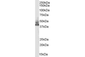 Image no. 1 for anti-Solute Carrier Family 9 (Sodium/hydrogen Exchanger), Member 3 Regulator 2 (SLC9A3R2) (Internal Region) antibody (ABIN374620) (SLC9A3R2 anticorps  (Internal Region))