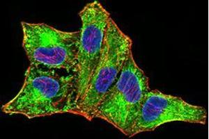 anti-DEAD (Asp-Glu-Ala-Asp) Box Polypeptide 58 (DDX58) (AA 789-925) antibody