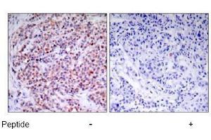 Image no. 1 for anti-Nuclear Factor-kB p65 (NFkBP65) (Thr435) antibody (ABIN197113) (NF-kB p65 anticorps  (Thr435))