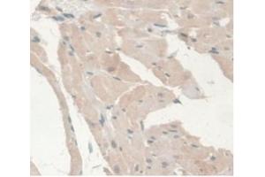 Detection of AR in Rat Heart Tissue using Monoclonal Antibody to Androgen Receptor (AR)