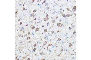 Immunohistochemistry of paraffin-embedded human esophageal using Parvalbumin (Parvalbumin (PVALB)) Rabbit pAb (ABIN6128526, ABIN6146506, ABIN6146507 and ABIN6217573) at dilution of 1:100 (40x lens). (PVALB anticorps  (AA 1-110))