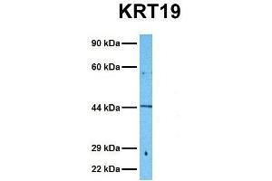 Host:  Rabbit  Target Name:  KRT19  Sample Tissue:  Human Fetal Kidney  Antibody Dilution:  1.