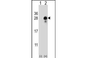 Western blot analysis of DLK2 (arrow) using rabbit polyclonal DLK2 Antibody (C-term) (ABIN652972 and ABIN2842616). (DLK2 anticorps  (C-Term))
