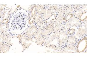 Detection of ALB in Human Kidney Tissue using Monoclonal Antibody to Albumin (ALB) (Albumin anticorps)