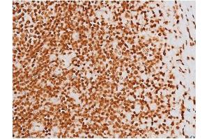ABIN6267604 at 1/200 staining Human tonsil tissue sections by IHC-P. (c-Rel anticorps  (pSer503))