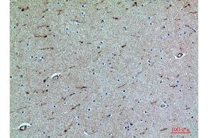 Immunohistochemistry (IHC) analysis of paraffin-embedded Human Brain, antibody was diluted at 1:100.