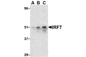 Western Blotting (WB) image for anti-Interferon Regulatory Factor 7 (IRF7) (C-Term) antibody (ABIN2475147) (IRF7 anticorps  (C-Term))