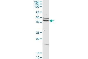 CCR5 MaxPab rabbit polyclonal antibody.
