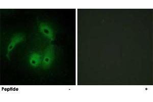 Immunofluorescence analysis of HeLa cells, using AKAP14 polyclonal antibody . (AKAP14 anticorps)