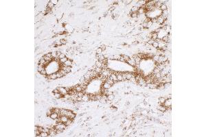 Immunohistochemistry (IHC) image for anti-ATP Synthase, H+ Transporting, Mitochondrial F1 Complex, alpha Subunit 1, Cardiac Muscle (ATP5A1) (AA 100-150) antibody (ABIN7453912)