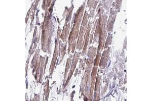 Immunohistochemical staining (Formalin-fixed paraffin-embedded sections) of human heart muscle with CD1E polyclonal antibody  shows moderate to strong cytoplasmic positivity in myocytes. (CD1e anticorps  (AA 79-147))