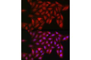 Immunofluorescence analysis of U2OS cells using LDHA Rabbit mAb  at dilution of 1:100 (40x lens). (Lactate Dehydrogenase A anticorps)