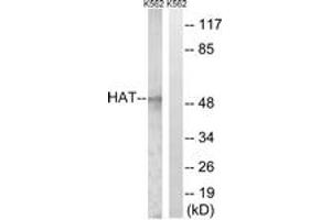 Western Blotting (WB) image for anti-Histone Acetyltransferase 1 (HAT1) (AA 331-380) antibody (ABIN2889272) (HAT1 anticorps  (AA 331-380))