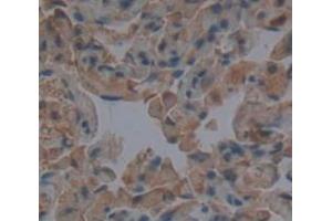 Used in DAB staining on fromalin fixed paraffin- embedded Kidney tissue