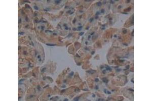 Used in DAB staining on fromalin fixed paraffin- embedded Kidney tissue (TUBD1 anticorps  (AA 190-453))