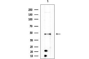 anti-Kallikrein 2 (KLK2) antibody