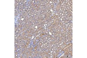 IHC analysis of TRMT61A using anti-TRMT61A antibody (ABIN7599220). (TRMT61A anticorps  (AA 1-289))