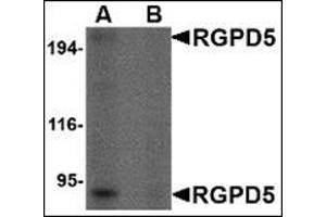 Western blot analysis of RGPD5 in human thymus tissue lysate with this product at 1 μg/ml in (A) the absence and (B) the presense of blocking peptide. (RGPD5 / RGPD6 (Center) anticorps)
