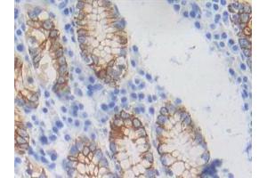 Detection of CYFRA21-1 in Human Stomach Tissue using Polyclonal Antibody to Cytokeratin Fragment Antigen 21-1 (CYFRA21-1)