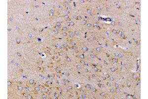 IHC analysis of ch TOG/CKAP5 using anti-ch TOG/CKAP5 antibody (ABIN6719294). (CKAP5 anticorps  (AA 1-221))