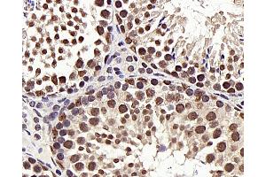 Immunohistochemistry analysis of paraffin-embedded mouse testis using HDAC1 Polyclonal Antibody at dilution of 1:300. (HDAC1 anticorps)