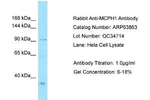 Western Blotting (WB) image for anti-Microcephalin 1 (MCPH1) (C-Term) antibody (ABIN2789647) (MCPH1 anticorps  (C-Term))