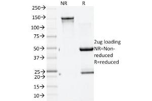 SDS-PAGE Analysis Purified GAD2 (GAD65) Mouse Monoclonal Antibody (GAD2/1960). (GAD65 anticorps  (AA 6-99))