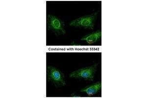 ICC/IF Image Immunofluorescence analysis of methanol-fixed HeLa, using Asporin, antibody at 1:200 dilution. (Asporin anticorps)