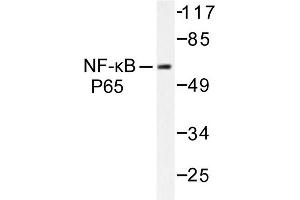 Image no. 1 for anti-Nuclear Factor-kB p65 (NFkBP65) antibody (ABIN271750) (NF-kB p65 anticorps)