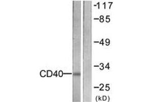 Western blot analysis of extracts from COS7 cells, using CD40 Antibody. (CD40 anticorps  (AA 228-277))