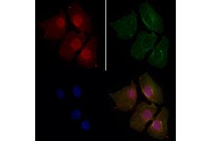 ABIN6264490 and ABIN6276475 staining Hela cells by IF/ICC.