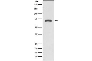 Western blot analysis of MMP8 expression in Human placenta lysate.