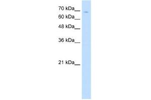 WB Suggested Anti-TCF25 Antibody Titration:  5. (TCF25 anticorps  (N-Term))