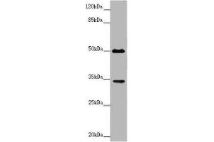 Western blot All lanes: FCGR2B antibody at 2 μg/mL + Mouse liver tissue Secondary Goat polyclonal to rabbit IgG at 1/10000 dilution Predicted band size: 35, 32, 34 kDa Observed band size: 35, 50 kDa