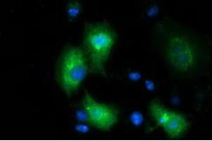 Anti-MGRN1 mouse monoclonal antibody (ABIN2454424) immunofluorescent staining of COS7 cells transiently transfected by pCMV6-ENTRY MGRN1 (RC208284). (Mahogunin RING Finger Protein 1 anticorps)