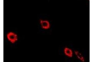 Immunofluorescent analysis of NEK3 staining in Hela cells.