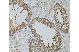 Immunohistochemistry of paraffin-embedded Human prostate using KTN1 Polyclonal Antibody at dilution of 1:100 (40x lens). (KTN1 anticorps)