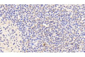 Detection of IL8Rb in Human Spleen Tissue using Polyclonal Antibody to Interleukin 8 Receptor Beta (IL8Rb) (CXCR2 anticorps  (AA 1-57))