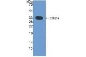 Detection of Recombinant CDK4, Human using Polyclonal Antibody to Cyclin Dependent Kinase 4 (CDK4)