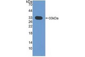 Detection of Recombinant CDK4, Human using Polyclonal Antibody to Cyclin Dependent Kinase 4 (CDK4) (CDK4 anticorps  (AA 6-295))