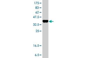 Western Blot detection against Immunogen (37.