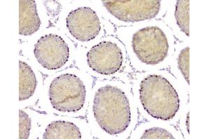 IHC analysis of DMRT1 using anti-DMRT1 antibody (ABIN3043450).