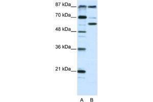 Western Blotting (WB) image for anti-K(lysine) Acetyltransferase 2B (KAT2B) antibody (ABIN2460477) (KAT2B anticorps)